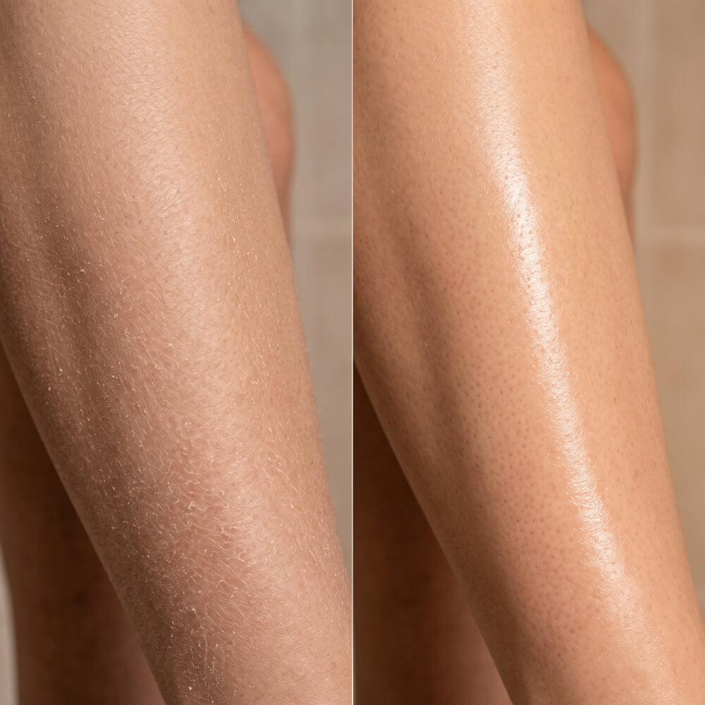 AI illustration 2: matching skin surfaces with and without loose flakes; not actual results